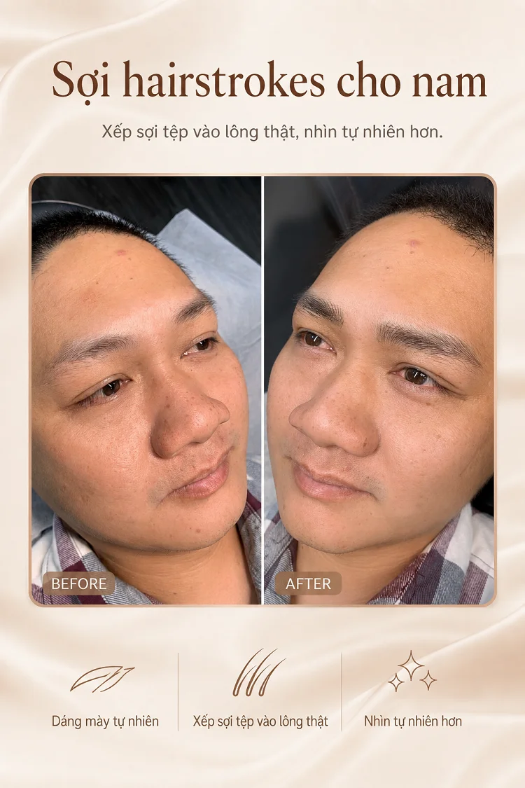 Phẩy sợi hairstroke cho Nam che sẹo