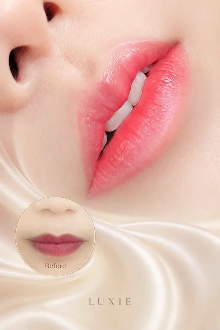 Trước và sau khi phun môi Xí muội tại Luxie