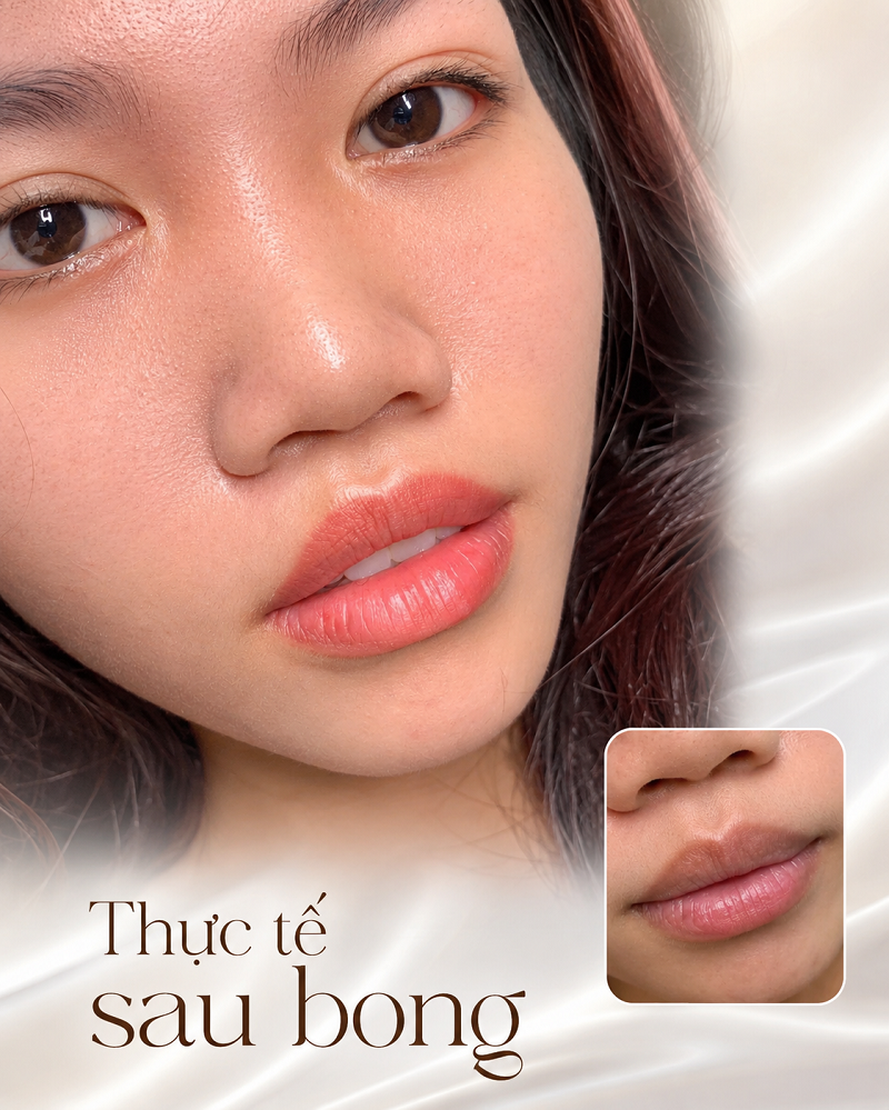 Hình ảnh thực tế sau bong của khử thâm môi