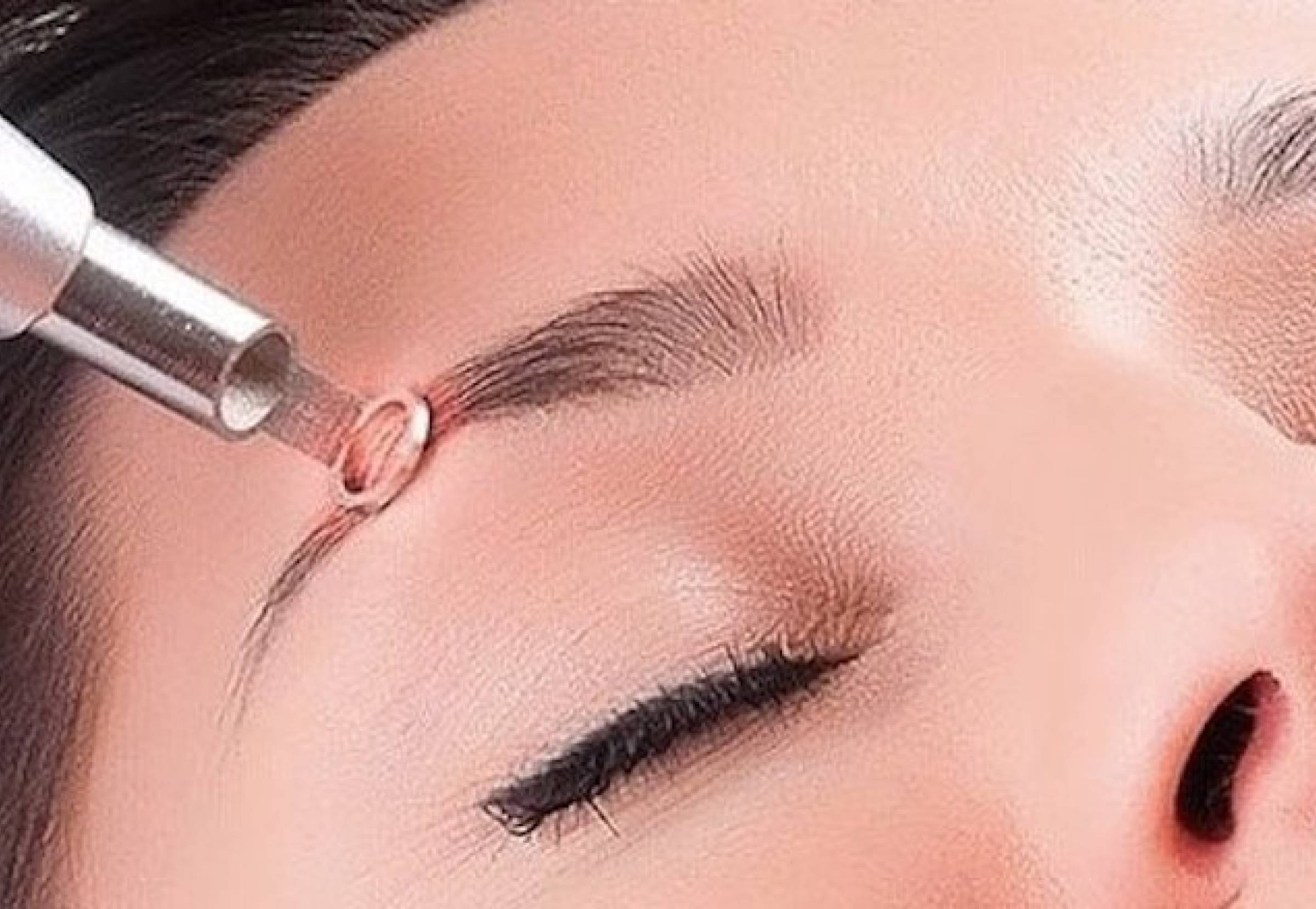 Xóa xăm lông mày bằng Laser công nghệ cao – Giải pháp an toàn, hiệu quả