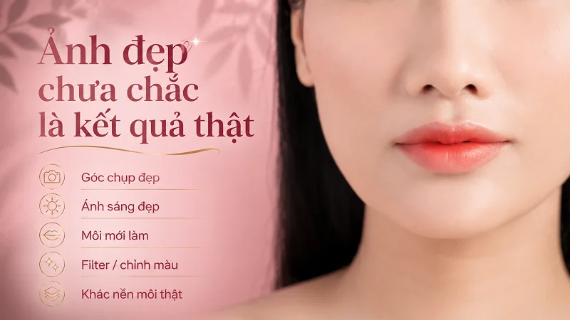 Ảnh phun môi xí muội trên mạng đẹp vì chúng chỉ cho bạn thấy một phần sự thật Ảnh phun môi xí muội trên mạng đẹp vì chúng chỉ cho bạn thấy một phần sự thật