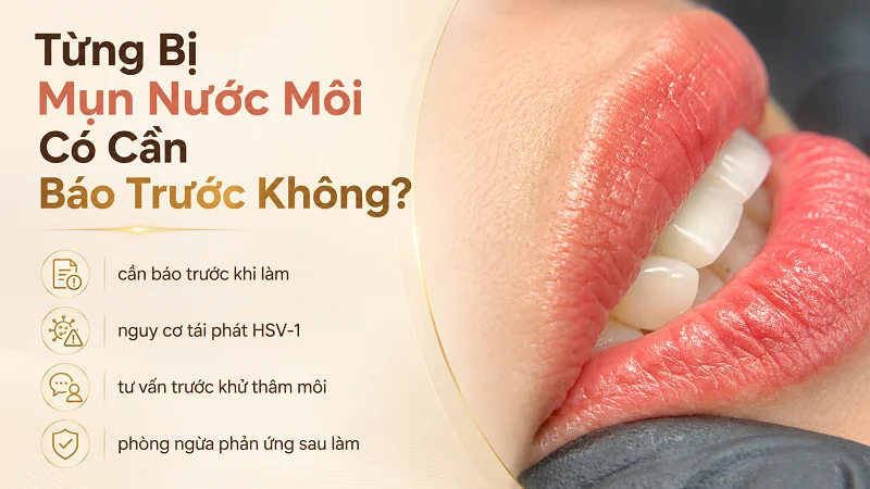 Từng bị mụn nước cần thông báo cho người tư vấn, kỹ thuật viên Từng bị mụn nước cần thông báo cho người tư vấn, kỹ thuật viên