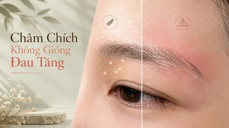 Châm chích, rát, căng và đau tăng khác nhau thế nào?