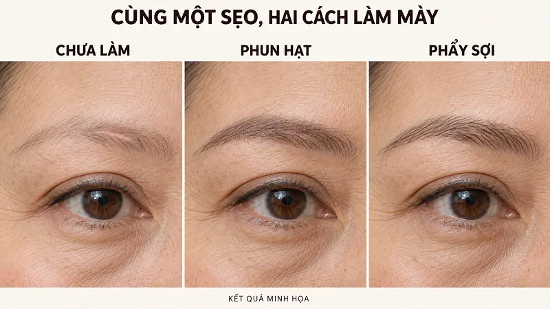 Phun mày che sẹo treo cung được đến đâu