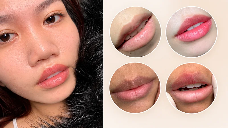 Hình ảnh thực tế khách hàng sử dụng dịch vụ khử thâm tại Luxie