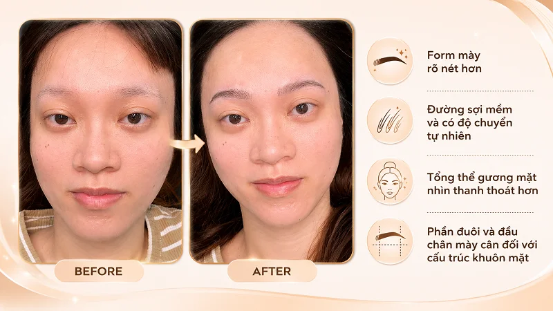 Kết quả thực tế của ca chân mày sợi trên nền da khó