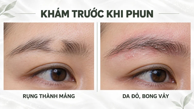 Khi nào nên đi khám da liễu trước?