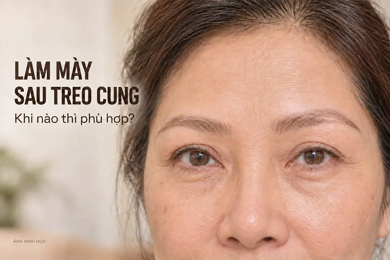 Treo Cung Chân Mày Bao Lâu Thì Phun Mày Che Sẹo Được?