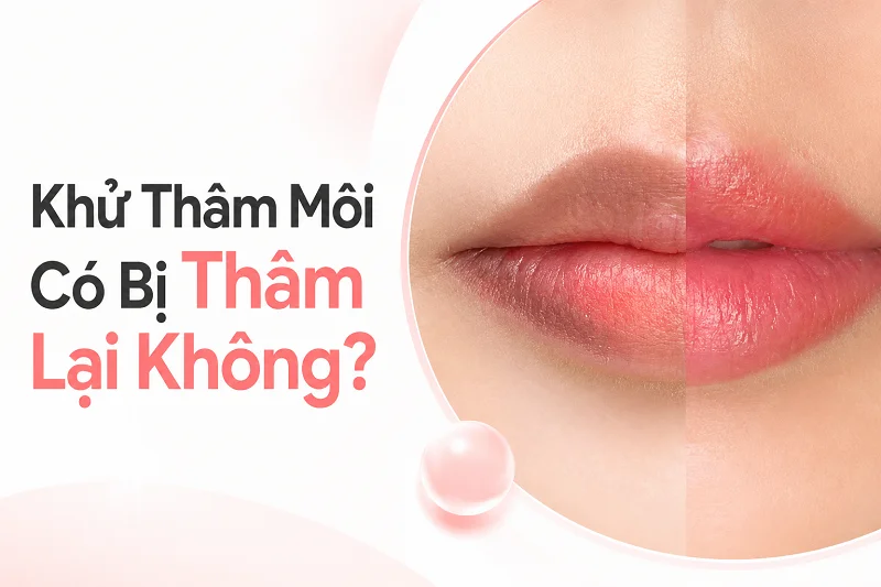  Khử Thâm Môi Có Bị Thâm Lại Không? Phân Biệt Hồi Màu, Phai Màu Và Tái Thâm