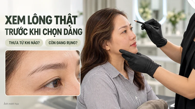 Đi tư vấn ở Luxie thì cần chuẩn bị gì?