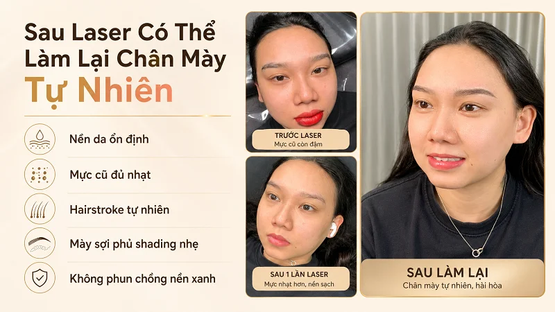 Sau laser có thể làm lại chân mày tự nhiên không?