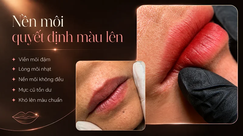Viền môi đậm, lòng môi nhạt nói lên điều gì về nền môi? Viền môi đậm, lòng môi nhạt nói lên điều gì về nền môi?