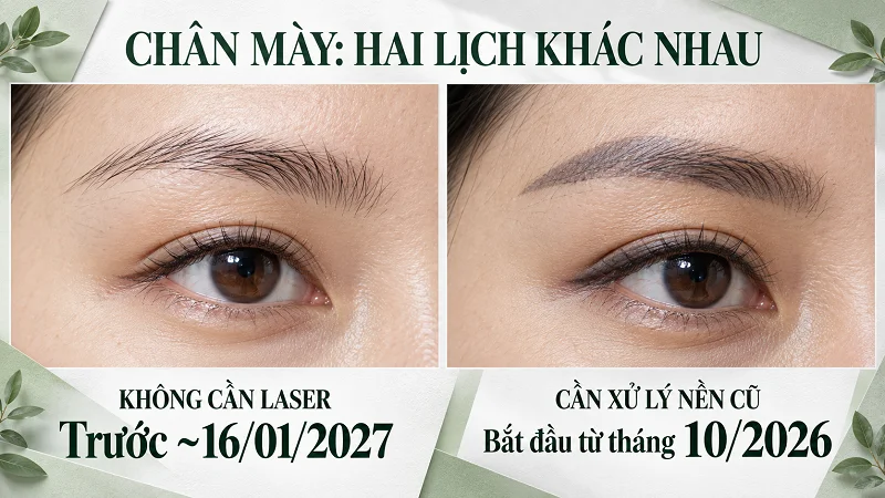 Chân mày: khoảng 15 ngày, trừ khi phải laser Chân mày: khoảng 15 ngày, trừ khi phải laser