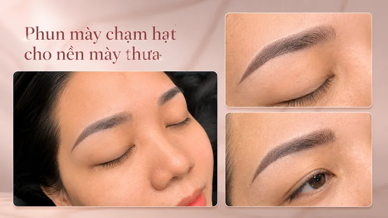 Nền mày thưa sau khi chạm hạt nhìn đầy hơn nhưng không nên bệt thành mảng.