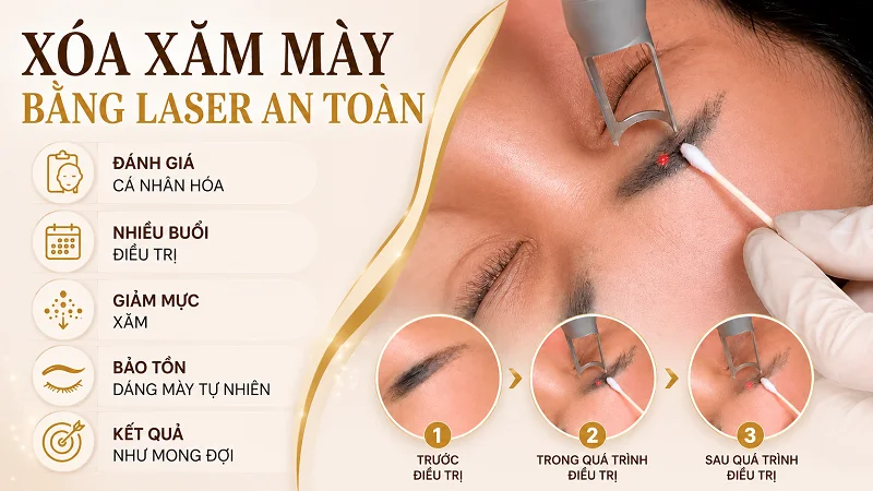 Xóa xăm chân mày bằng laser là gì và hoạt động như thế nào?