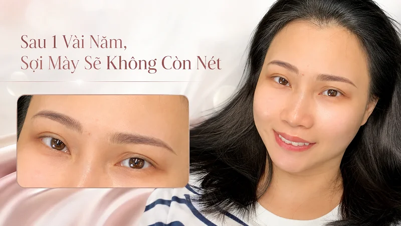 Phẩy sợi lông mày sẽ nở và không còn nét sau 1 vài năm