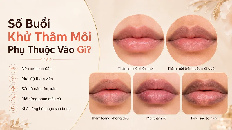 Vì sao cùng là môi thâm nhưng số buổi xử lý lại khác nhau?