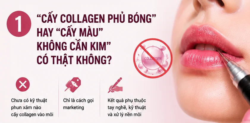 Cân nhắc kỹ khi được tư vấn những dịch vụ cấy môi không kim, collagen