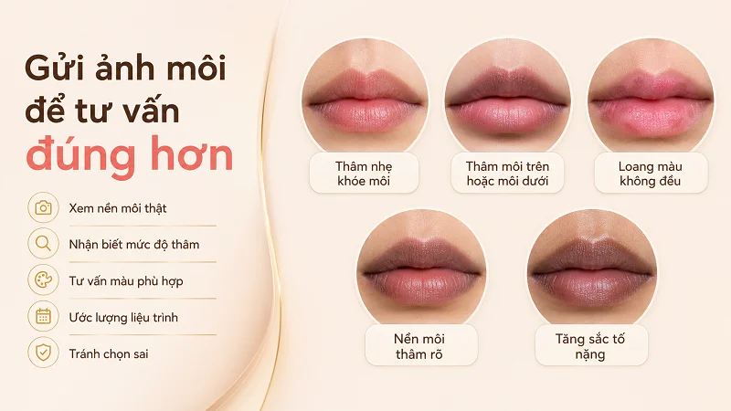 Nền môi của bạn đang thâm, nhợt hay không đều màu? Nền môi của bạn đang thâm, nhợt hay không đều màu?