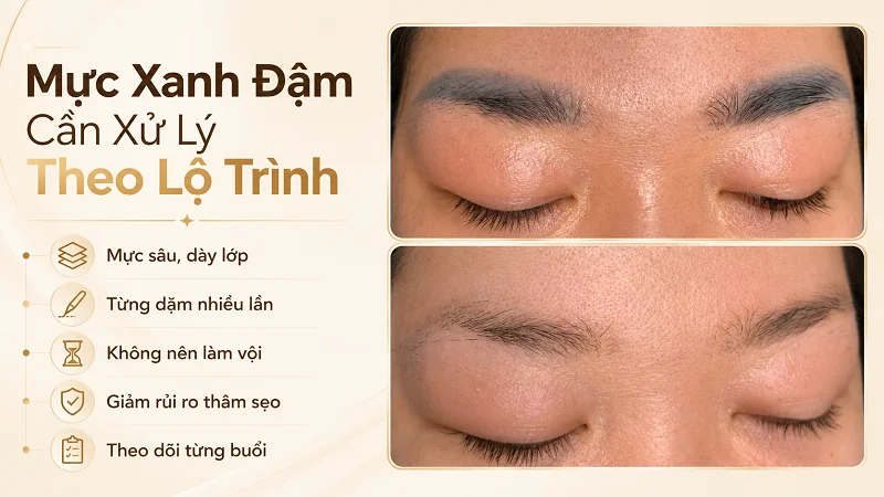 Khi nào mày trổ xanh cần xử lý nhiều buổi?