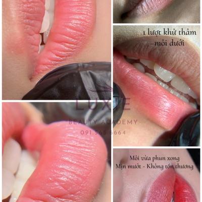 Khách hàng sử dụng dịch vụ khử thâm môi tại Luxie