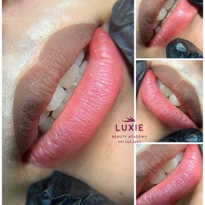 Khách hàng sử dụng dịch vụ khử thâm môi tại Luxie