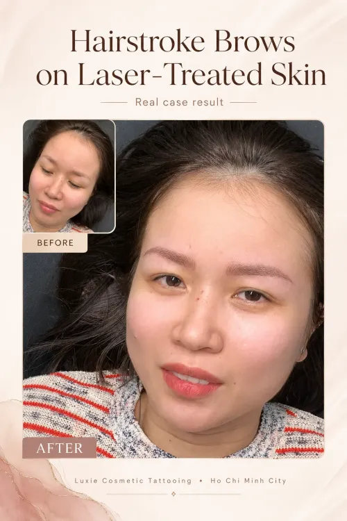 Hairstroke Brows Real Case Result